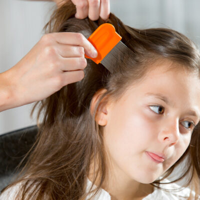 Home remedies to effectively treat head lice