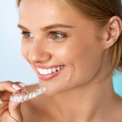 Know more about the different types of braces