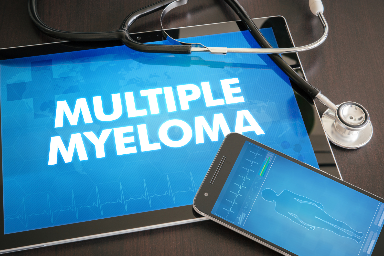 Treatment Options for Multiple Myeloma