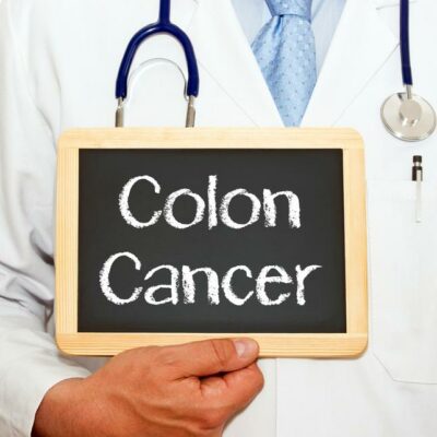 Risk Factors for Colon Cancer