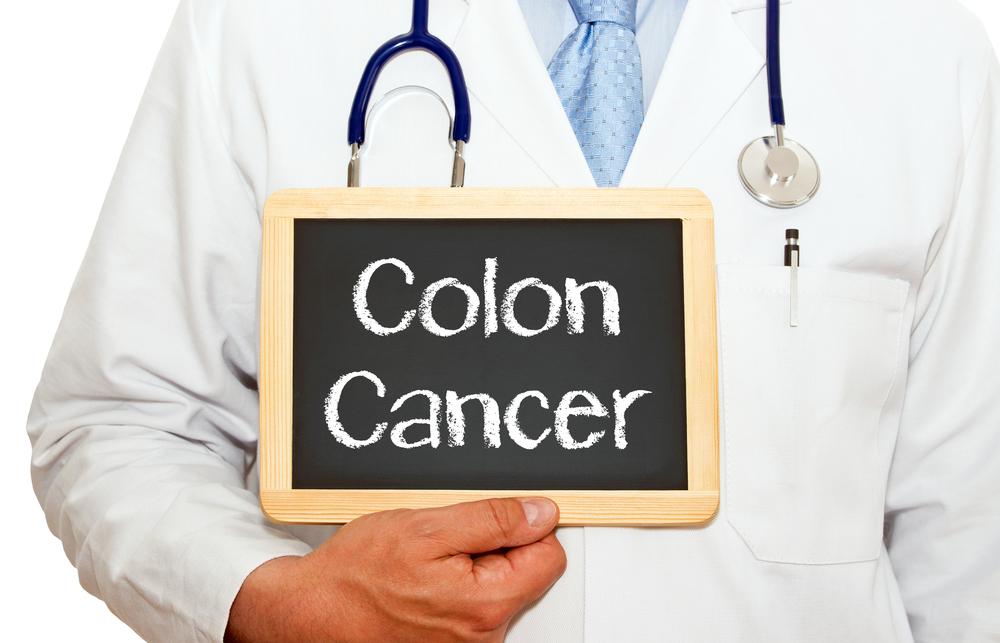 Risk Factors for Colon Cancer